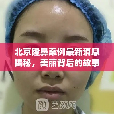 举世无双